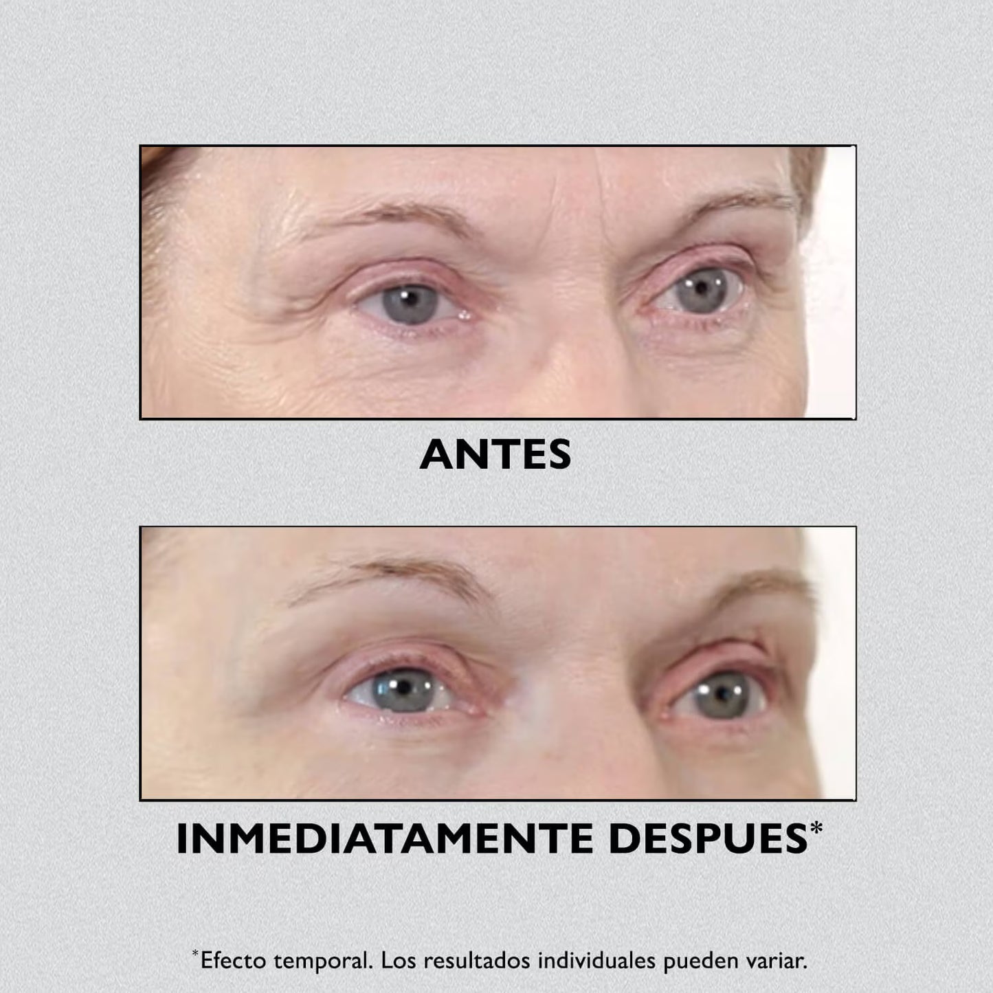 INSTANT FIRMX EYES - Firmeza al instante